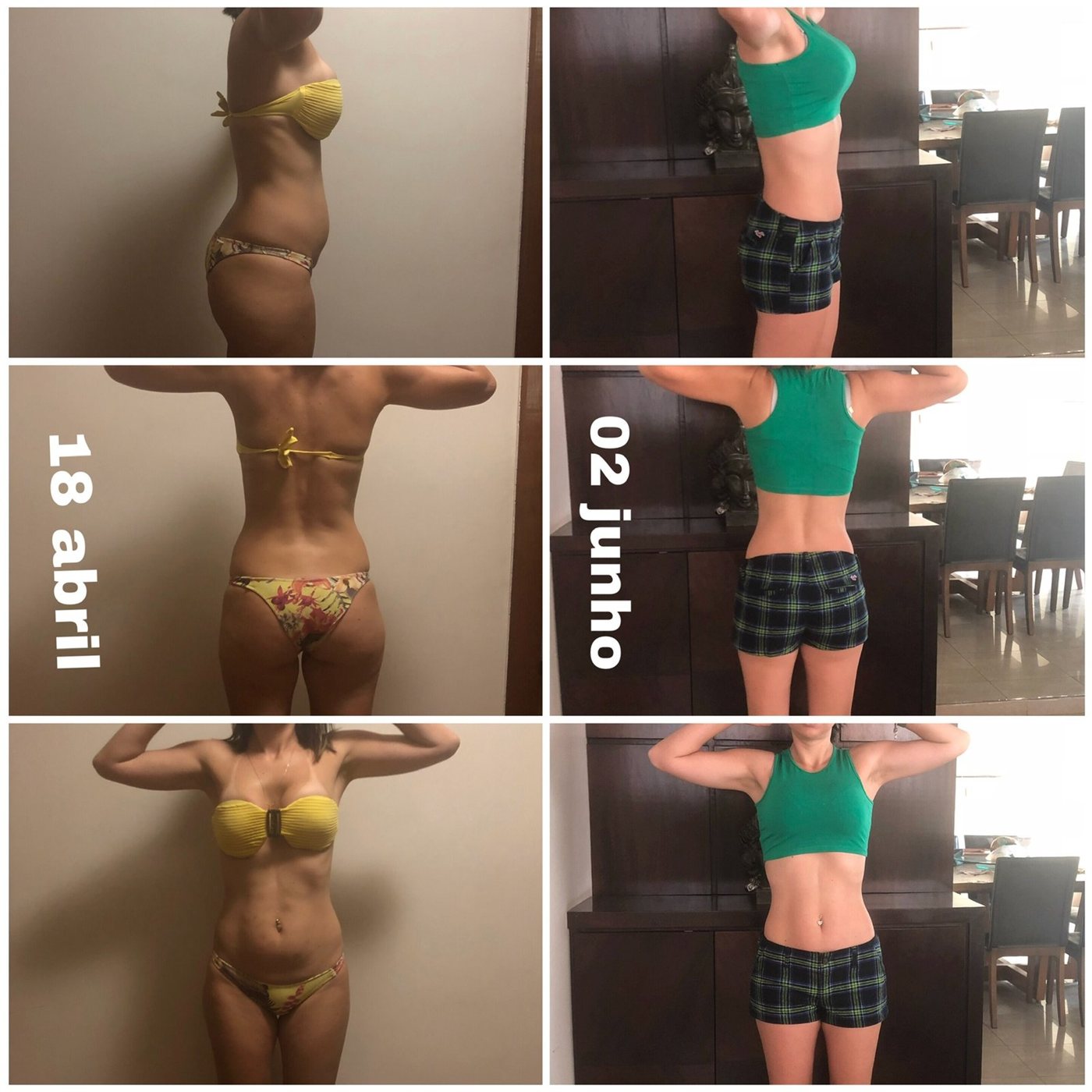 Lipo sem cortes com aplicação de ativos